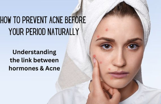How to Prevent Acne Before Your Period Naturally - Makeup Stash Pakistan