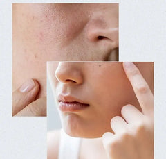 Anua Birch 70 Moisture boosting Serum 30ml-Makeup Stash Pakistan