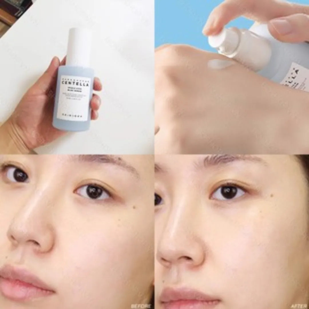 Skin1004 - Madagascar Centella Hyalu-Cica Blue Serum 50ml  -Makeup Stash Pakistan Skin1004 - Madagascar Centella Hyalu-Cica Blue Serum 50ml  -Makeup Stash Pakistan