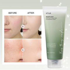 Anua Heartleaf Succinic Moisture Cleansing Foam 150 ML - Makeup Stash Pakistan