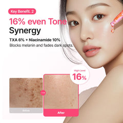 Niacinamide 10 serum, Retinal serum , dark spot corrector, Korean skincare serum, hyperpigmentation treatment, acne marks serum, brightening serum, anti-aging serum, Purito serum original - Makeup Stash Pakistan