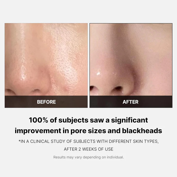 Medicube Zero Pore Pad 2.0 - 70 pads - Makeup Stash Pakistan Medicube Zero Pore Pad 2.0 - 70 pads - Makeup Stash Pakistan
