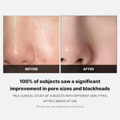 Medicube Zero Pore Pad 2.0 - 70 pads - Makeup Stash Pakistan