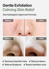 Exfoliating toner pads, Salicylic acid pads, Acne treatment pads, Korean Skincare Exfoliator, Pore Cleansing pads, Blackhead Removal pads, Oily Skin Exfoliating pads, Gentle Chemical Exfoliation, Heartleaf skincare - Makeup Stash Pakistan