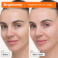 Brightamin ampoule, vitamin C serum, brightening serum, glow skin serum, Korean skincare serum, dark spot treatment, pigmentation serum - Makeup Stash Pakistan