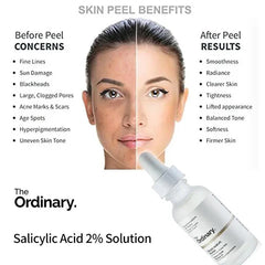 Salicylic Acid 2%, Acne Serum Pakistan, Blackhead Treatment Serum, BHA Exfoliant, Oil Control Serum, The Ordinary Pakistan, Pore Cleansing Serum, Face Serum 30ml, Skincare Pakistan - Makeup Stash Pakistan