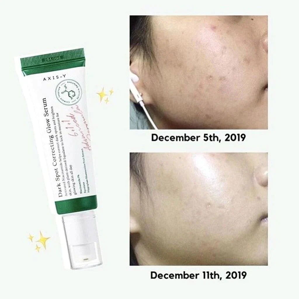 Axis-Y Dark Spot Correction Glow Serum 5ML - Makeup Stash Pakistan Axis-Y Dark Spot Correction Glow Serum 5ML - Makeup Stash Pakistan