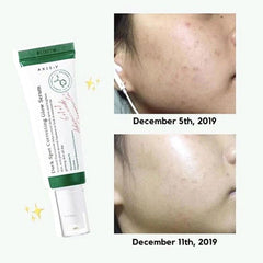 Axis-Y Dark Spot Correction Glow Serum 5ML - Makeup Stash Pakistan