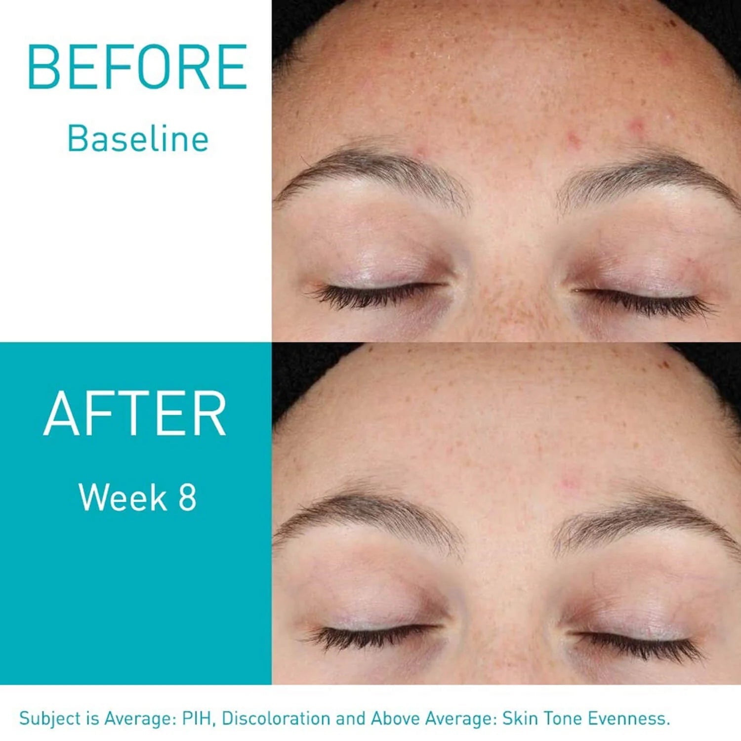 Cerave Resurfacing Retinol Serum - Makeup Stash Pakistan Cerave Resurfacing Retinol Serum - Makeup Stash Pakistan