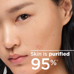 Cleansing Solution, Oily Skin, AcneProne Skin, Cleanser, Makeupstashpk