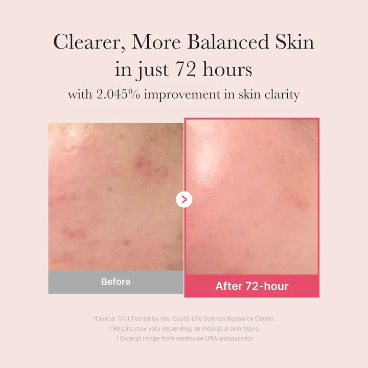 Dark Spot Corrector, Korean Brightening Serum,Face Glow Serum, Pore Minimizing Serum, Hyperpigmentation TreatmentAcne Marks Treatment, Skin Brightening Serum, Makeup Stash Pakistan