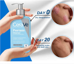 Cerave Psoriasis Cleanser 237 ml