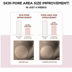 Poremizing Toner, Exfoliating Toner, Hydrating Toner, Centella Asiatica Toner, Korean Skincare Toner, Toner for Oily Skin, Smooth Skin Toner, Makeupstashpk