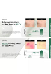 Anua - Heartleaf Centella Red Spot Cream 30ml - Makeup Stash Paksitan