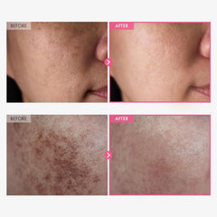 arbutin 5 whitening cream, tosowoong whitening cream, brightening face cream, arbutin face cream, dark spot cream, skin brightening cream, uneven skin tone cream, korean skincare cream, moisturizing whitening cream, radiant skin cream - Makeupstashpk