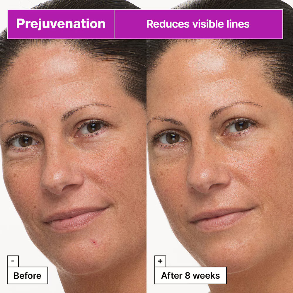 anti aging cream, firming moisturizer, retinol alternative cream, Korean skincare anti aging, wrinkle cream, skin firming cream, sensitive skin anti aging, hydrating face cream, youthful skin cream, smooth skin moisturizer - Makeup Stash Pakistan