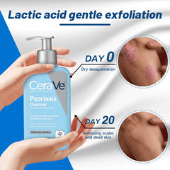 Face and Body Wash , Cleanser , psoriasis-prone , Cerave Sensitive Skin Cleanser , Makeupstashpk