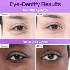 Numbuzin – No.9 NAD+ Collagen +50 Peptides Eye Patches 8g - Makeup Stash Pakistan