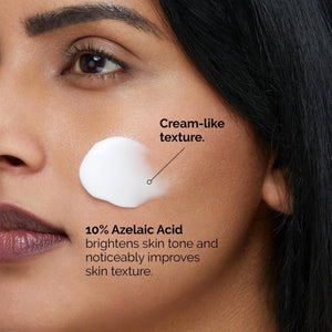Acne Treatment Cream, Redness Relief Serum, Dark Spot Cream,Skin Brightening Cream, Post Acne Marks Treatment, Face Cream - Makeup Stash Pakistan