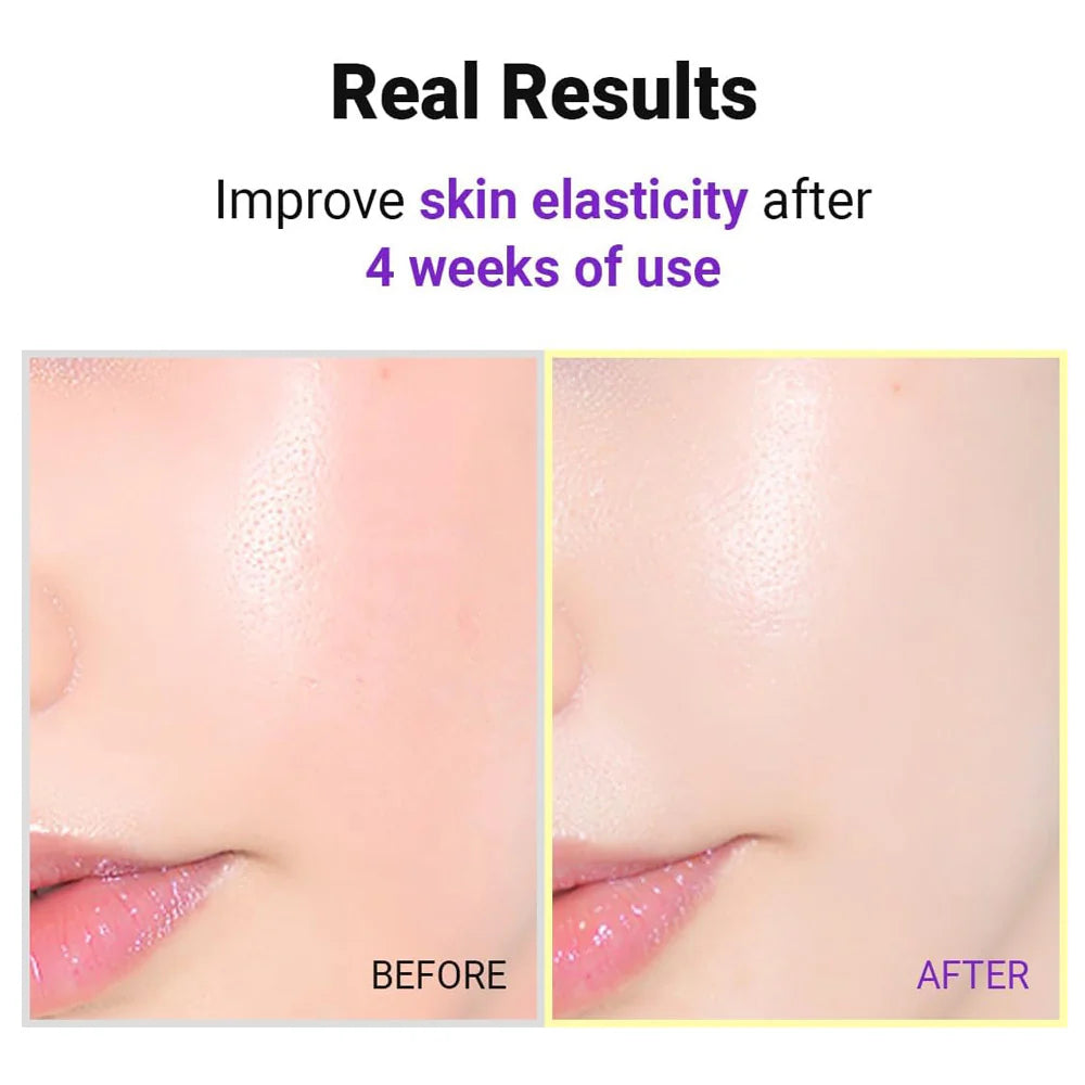 Isntree - Hyper Retinol Ex 1.0 Serum 20ml - Makeup Stash Pakistan