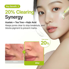 Purito,Azelaic Acid,Serum,Korean Serum,Brightening,Acne Care Treatment,Makeupstashpk