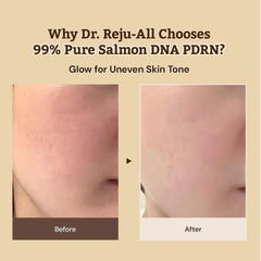 Skin Repair Cream, Anti Aging Cream, Skin Barrier Repair, Korean Skincare, Regeneration Cream, Healing Face Cream, Sensitive Skin Cream, Wrinkle Repair Cream, Hydrating Cream - Makeup Stash Pakistan