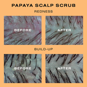 Exfoliating ,Detoxifying ,Treatment , Hair Care , Makeup Stash Pakistan