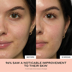 Brightening , Pore Refining ,Face Serum, Glow Skin , Niacinamide Serum - Makeup Stash Pakistan