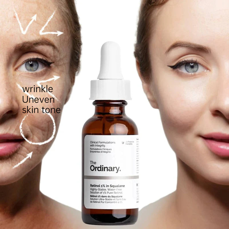 Retinol Serum Pakistan, Anti Aging Serum, Acne Treatment Serum, Squalane Retinol, Wrinkle Treatment, The Ordinary Pakistan, Skin Renewal Serum, Face Serum 30ml, Skincare Pakistanl - Makeup Stash Pakistan