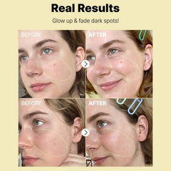 Cosrx - The Vitamin C13 Super Vitamin E + Hyaluronic Acid 20g-MakeupStash Pakistan