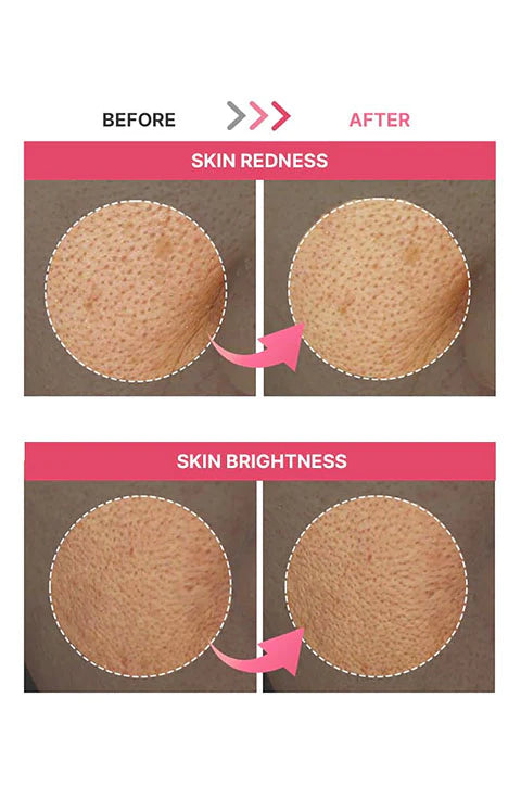 Hydrogel Mask, Hydrating Face Mask Pakistan, Firming Face Mask, Korean Skincare Mask, Anti-Aging Mask, Revitalizing Face Mask, Moisturizing Hydrogel Mask, Plumping Skin Mask, Skin Elasticity Mask, Makeup Stash Pakistan