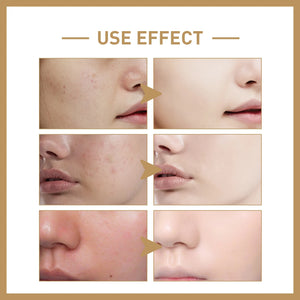 Rice Serum c,Brightening , Hydrating Korean Serum , Rice Extract , Glowing Skin - Makeup Stash Pakistan