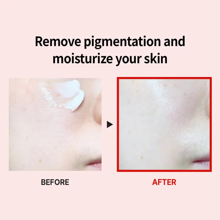 Medi-Peel - Melanon X Drop Gel Cream 50g - Makeup Stash Pakistan