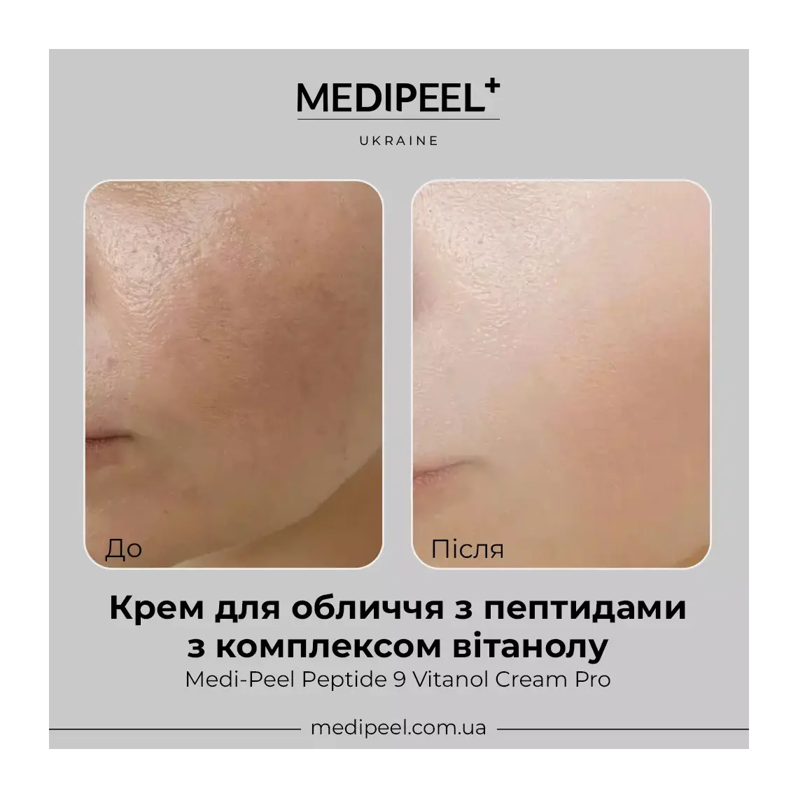 Medi-Peel - Peptide 9 Vitanol Cream Pro 50g - Makeup Stash Pakistan