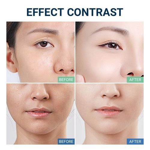 Toning Lotion , Hydrating Face Toner , Alcohol-Free , Normal to Dry Skin , Makeupstashpk