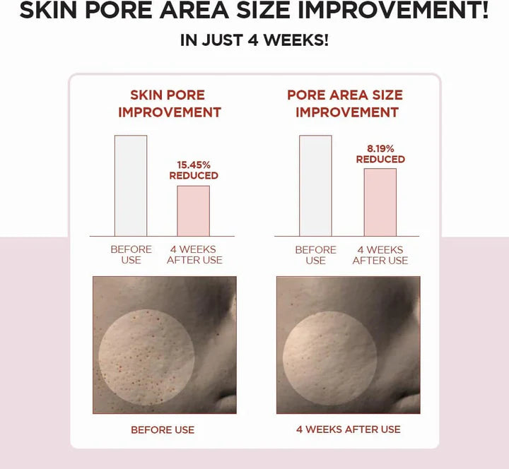 Skin1004 - Madagascar Centella Poremizing Clear Toner 210ml - Makeup Stash Pakistan
