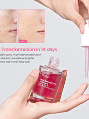 Anua  Niacinamide 10+ TXA 4 Serum 30ml -Makeup Stash Pakistah