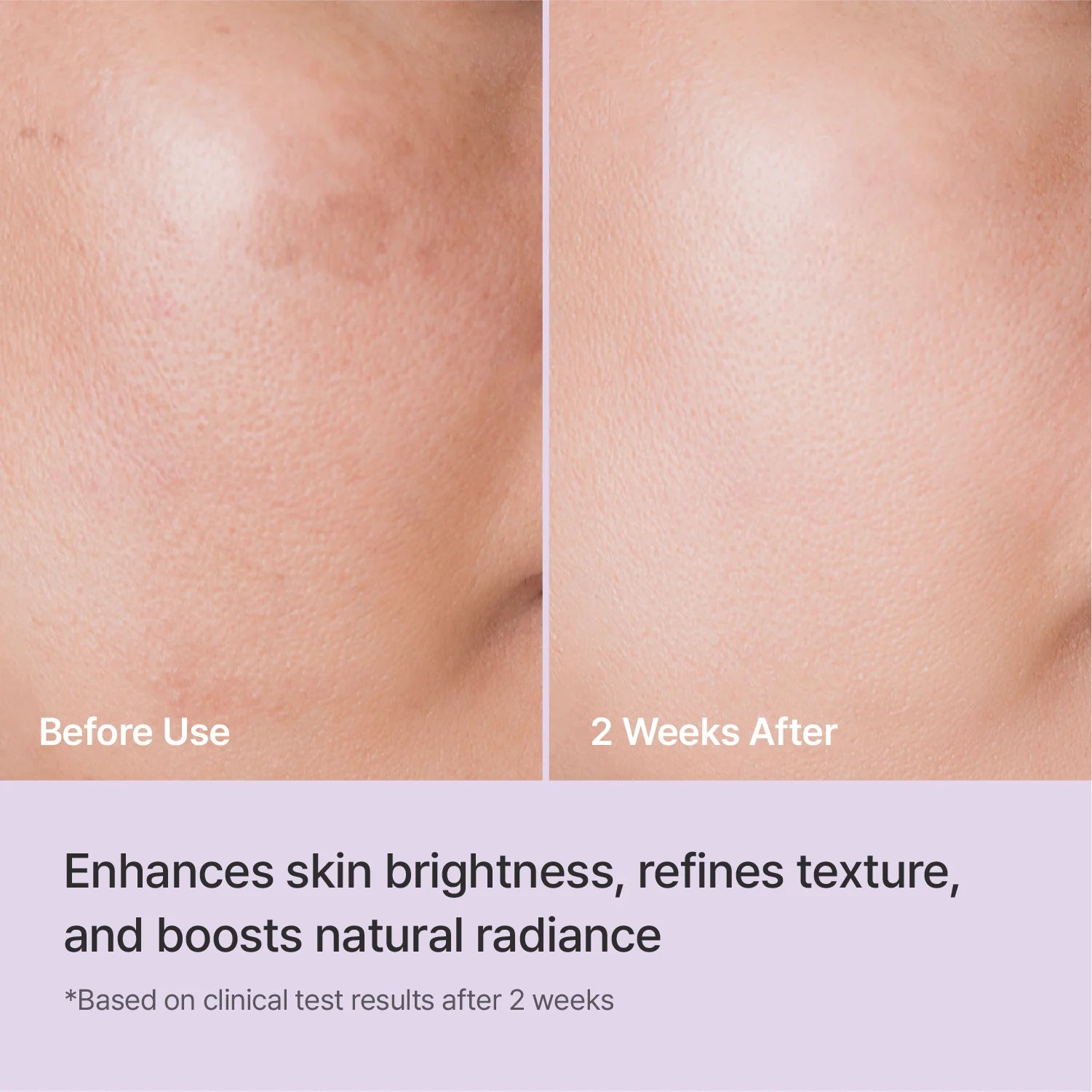 Brightening Serum Korea, Glow Serum, Hydrating Ampoule, Korean Skincare Serum, Glass Skin Serum, Radiance Boost Serum, Even Skin Tone Serum, K Beauty Ampoule, Skin Glow Booster - Makeup Stash Pakistan