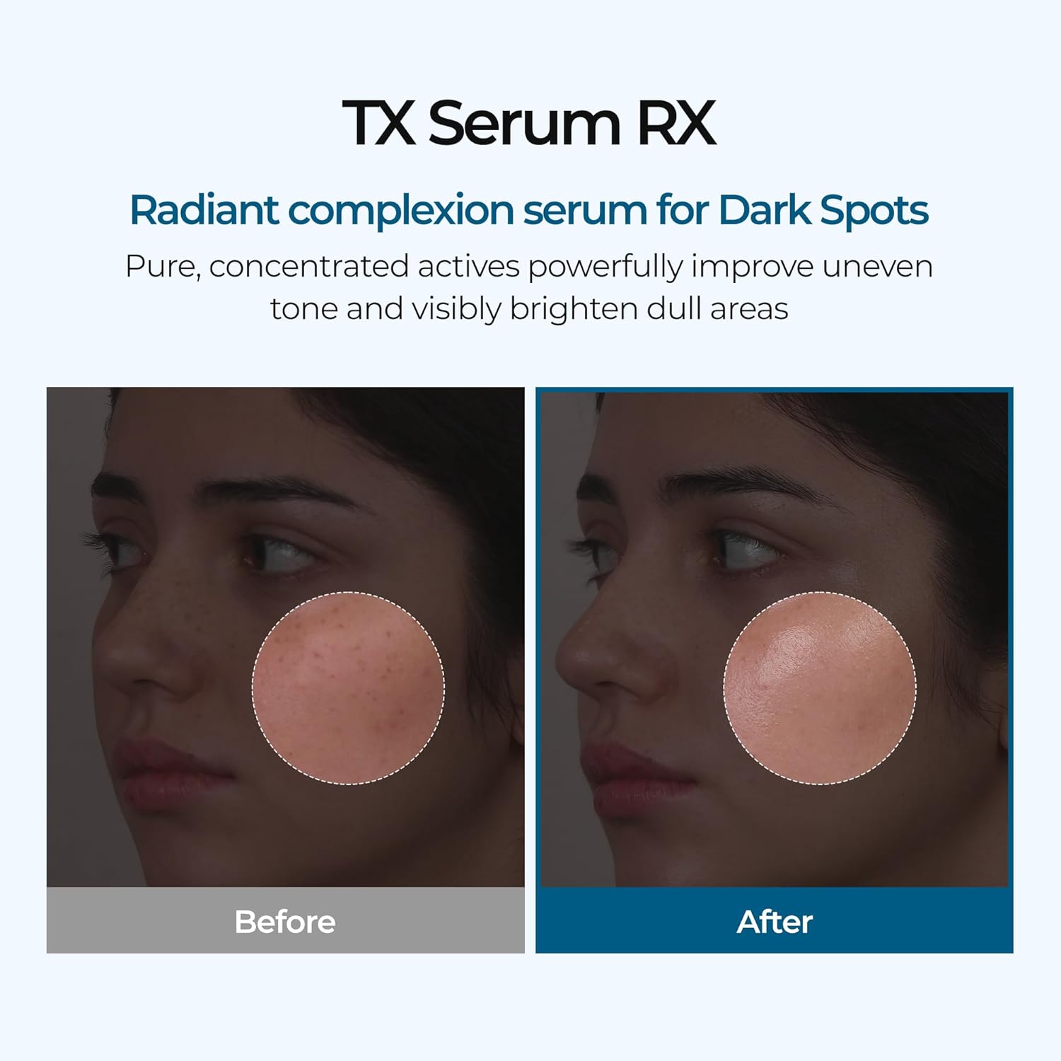 TX ampoule serum, brightening serum, dark spot treatment, pigmentation serum, Korean skincare serum, uneven skin tone, glow skin serum,acne mark removal, lightweight serum, radiant skin treatment, hyperpigmentation care, Makeup Stash Pakistan