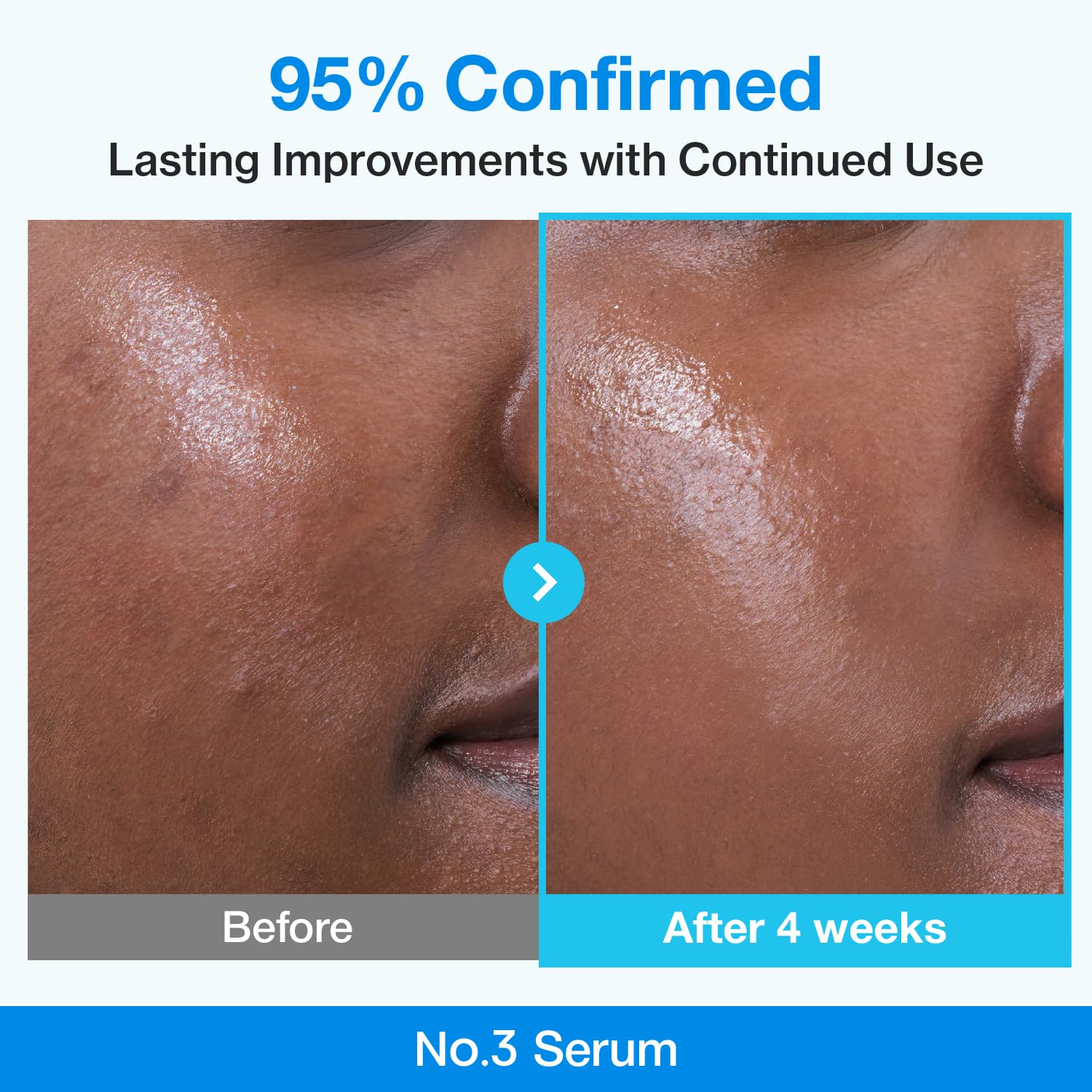 Numbuzin - No.3 Blue Bio-Retinol Pore Refining Serum 30ml - Makeup Stash Pakistan