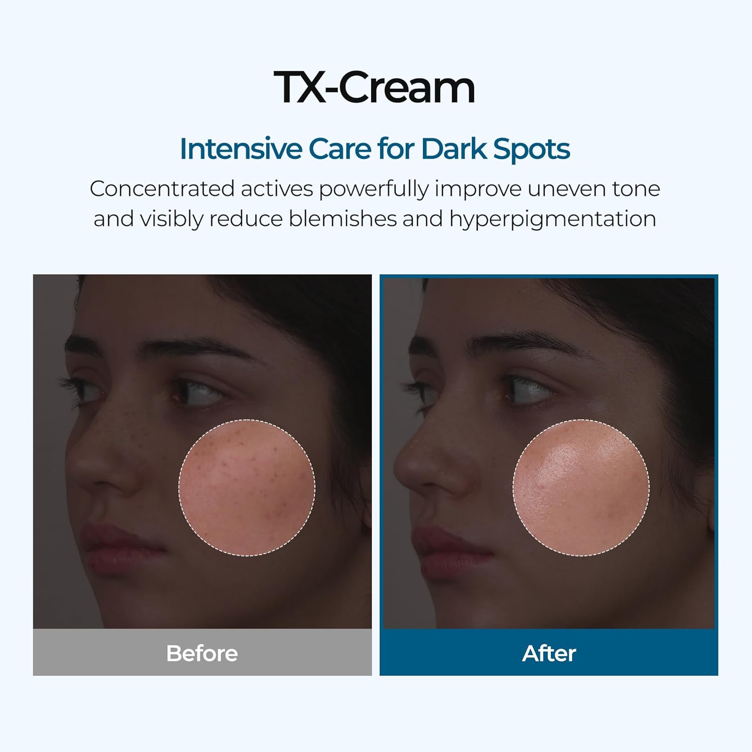 brightening cream, dark spot removal cream, pigmentation treatment cream, Korean skincare cream, uneven skin tone moisturizer, glow cream, acne mark cream -Makeup Stash Pakistan