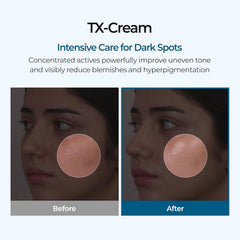 brightening cream, dark spot removal cream, pigmentation treatment cream, Korean skincare cream, uneven skin tone moisturizer, glow cream, acne mark cream -Makeup Stash Pakistan
