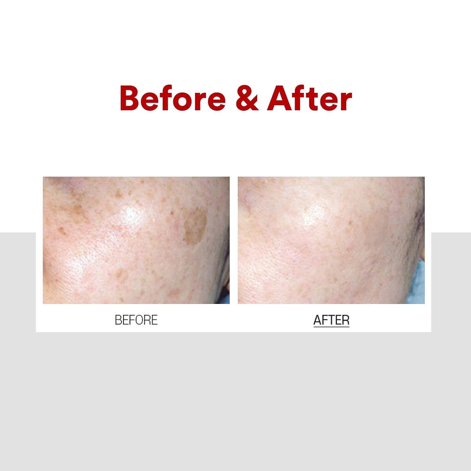 Dark Spot Corrector Cream, Hyperpigmentation Treatment, Korean Brightening ream, Melanin Reduction Cream, Makeupstashpk