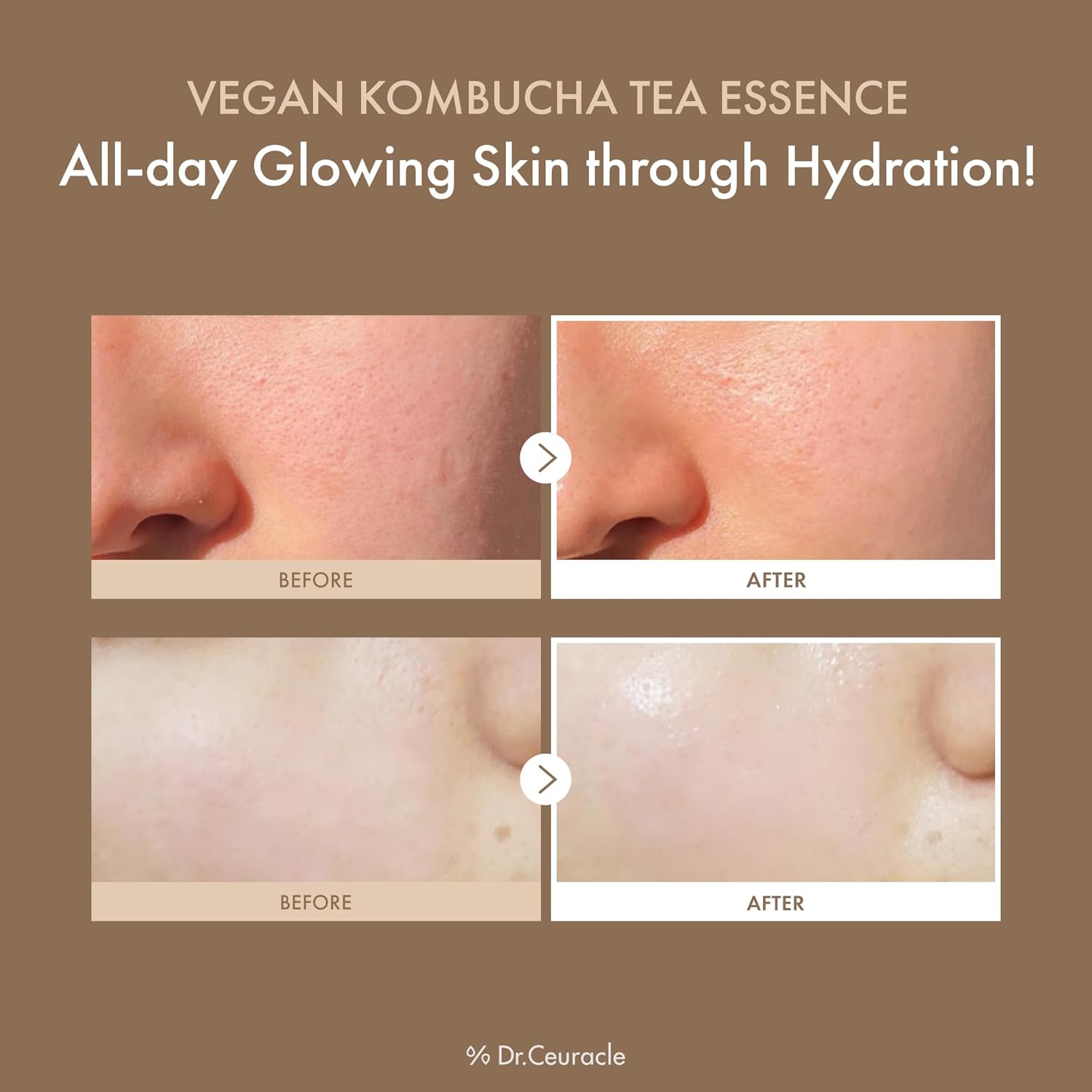 vegan kombucha essence, hydrating essence, barrier repair skincare, probiotic skincare, Korean essence, glowing skin essence,antioxidant skincare, glass skin routine, nourishing essence, fermented skincare, sensitive skin essence  - Makeup Stash Pakistan