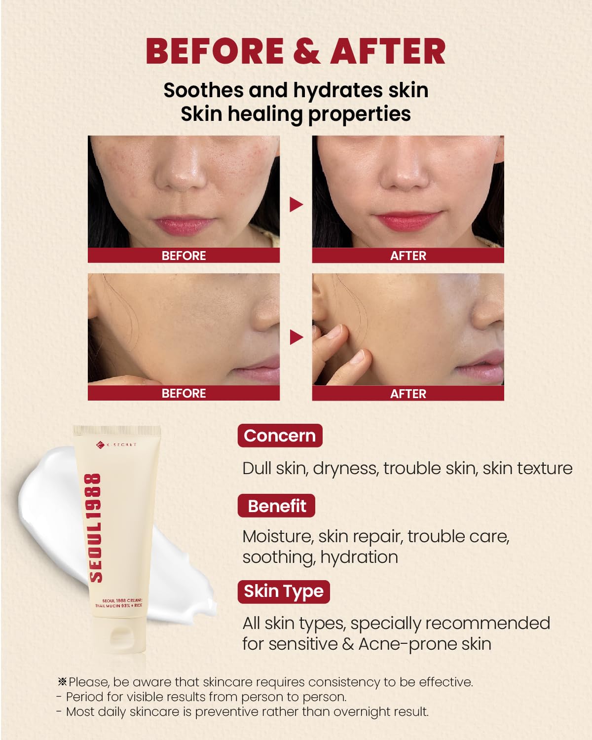 K-Secret,Face Cream,Moisturizer,Hydrating,Lightweight,long-lasting,Creamy texture,Makeupstashpk