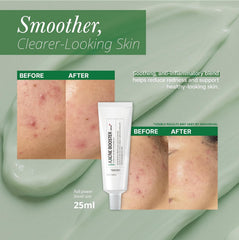 booster cream, axcne cream, acne booster cream, acne care cream, pimple treatment cream, blemish control cream, acne-prone skin care, oil control cream, face cream for acne, skincare for oily skin, anti acne cream, acne solution cream, clear skin cream - Makeupstash