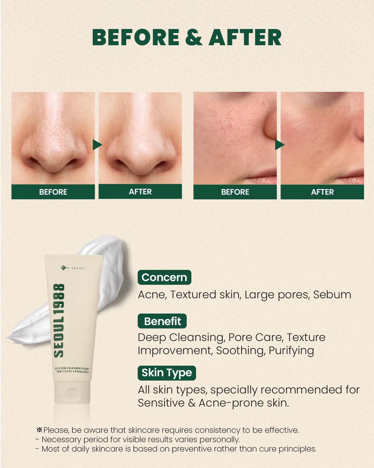 K-Secret - Seoul 1988 Pine Cica 1% + Probiotics Cleansing Foam 150ml - Makeup Stash Pakistan