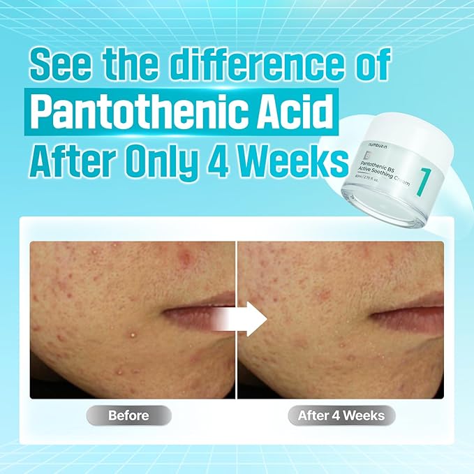 Numbuzin – No. 1 Pantothenic B5 Active Soothing Cream 50ml - Makeup Stash Pakistan