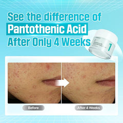 Numbuzin – No. 1 Pantothenic B5 Active Soothing Cream 50ml - Makeup Stash Pakistan