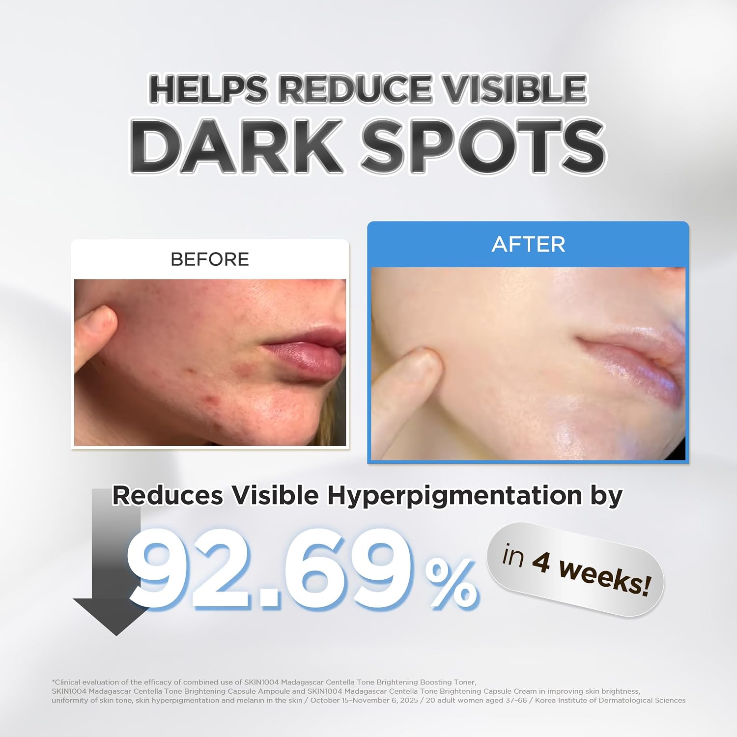 Dark Spot Corrector,Hyperpigmentation Treatment, Glowing Skin Serum, Sensitive Skin Care, Hydrating Ampoule, K Beauty Skincare, Skin Barrier Repair, Even Skin Tone, Centella Skincare, Facial Serum, Korean Beauty Products, Radiant Skin Care - Makeustashpk